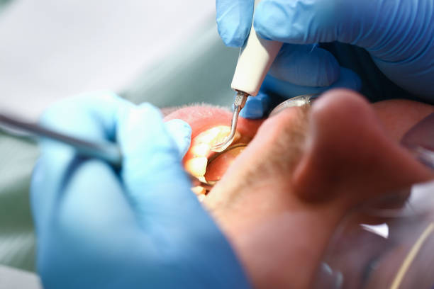 Best Pediatric Emergency Dentist in Forestville, OH