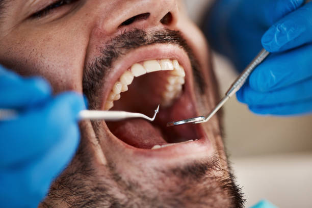 Best Emergency Gum Treatment in Forestville, OH