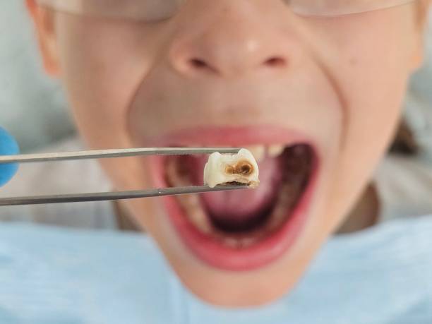 Best Cosmetic Emergency Dentistry in Forestville, OH